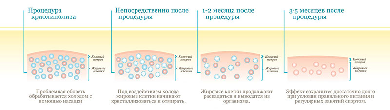 kr1