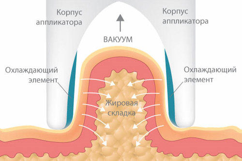 kr4